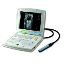 Scanner à ultrasons numérique complet pour ordinateur portable 2D médical